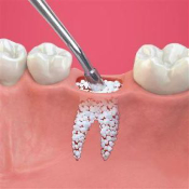 Gums