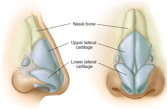 Rhinoplasty