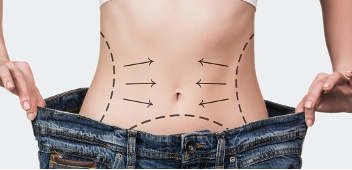 Tummy Tuck